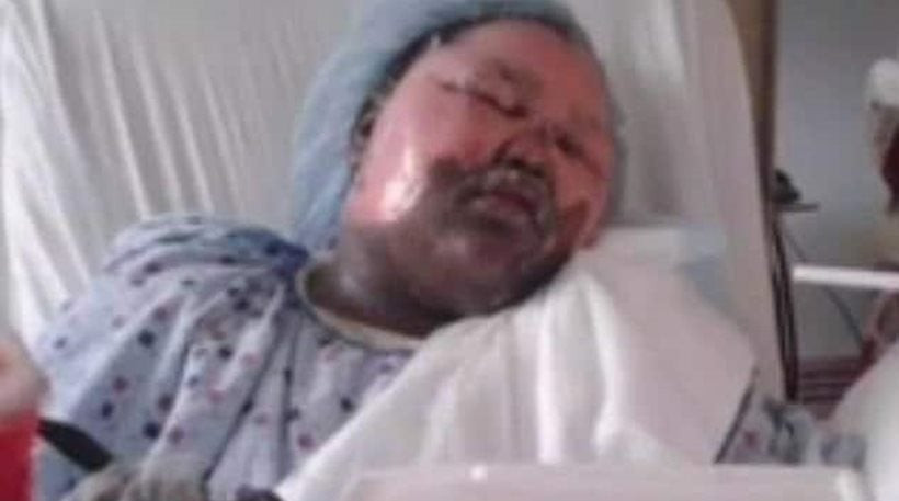 11χρονη πέταξε καυτό νερό στη φίλη της ενώ κοιμόταν γιατί είχαν τσακωθεί